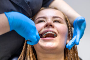 The Role of Braces in Improving Overall Health