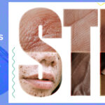 STD risk assessment
