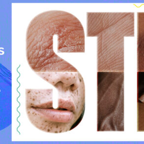 STD risk assessment